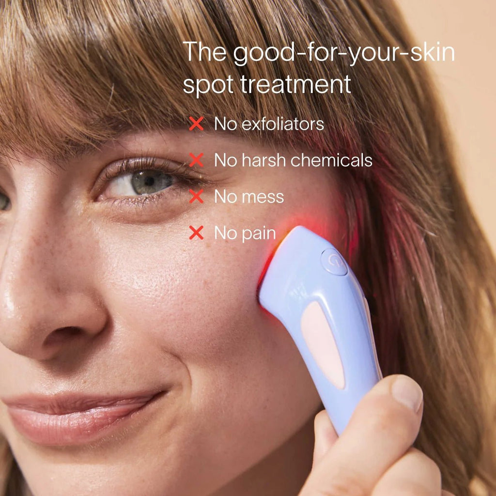 Bye Acne: 3 - Minute Pimple Spot Treatment - Mac's Got More